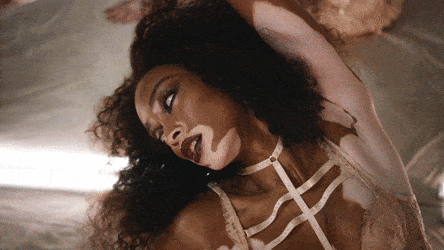 Winnie Harlow See Through Photos 002