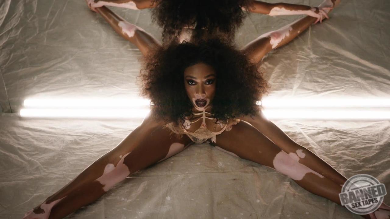 Winnie Harlow See Through Photos 021