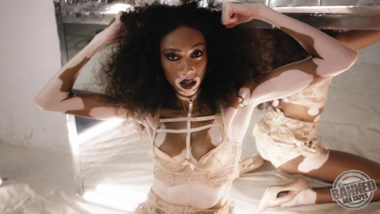 Winnie Harlow See Through Photos 034