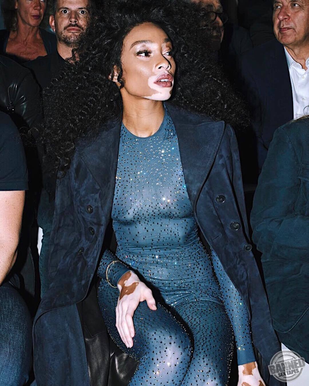 Winnie Harlow See Through Photos 047