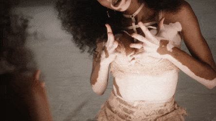 Winnie Harlow See Through Photos 017