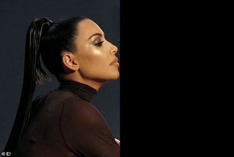 Vitiligo Brown Queen Kim Kardashian Sexy Thefappeningblog.com 9 768x516